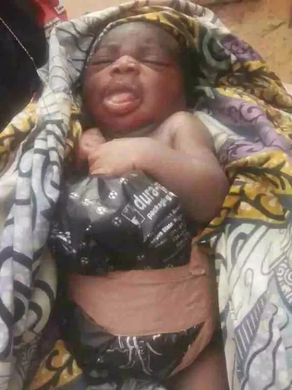 Baby Born With Intestines Outside The Body In Niger State (Graphic Photos)